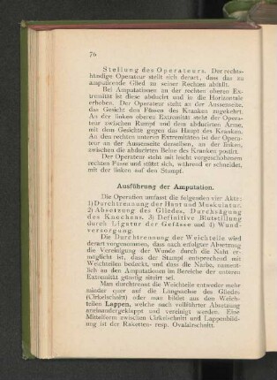Ausführung der Amputation.
