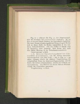 Fig. 67 a. Augenspiegelbild der Netzhaut bei perniciöser Anämie. Fig. 67 b. Kleiner Entzündungsherd bei Chorioditis disseminata.