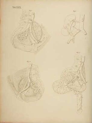 Seltene Abweichung der Arterien der rechten Niere aus dem Leichnahm eines Mannes (Lineartafel)