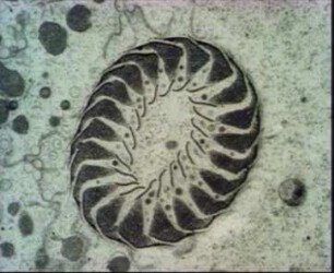 Nahrungsaufnahme und Verdauung bei dem Ciliaten Pseudomicrothorax dubius