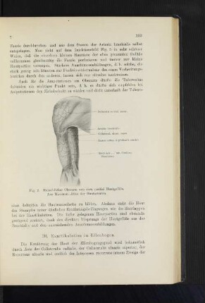 III. Exartikulation im Ellenbogen.