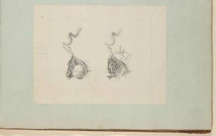 Augenarterie mit sowie Verästelung der Augenarterie ohne Augapfel [Vorzeichnung zu Samuel Thomas Soemmerring, Abbildungen des menschlichen Auges, Frankfurt am Main 1801, Tafel IV ("schattierte" Darstellung), Fig. I und II]