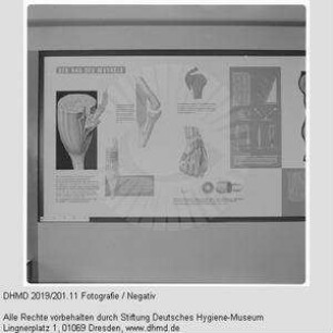 Nationale Hygiene-Ausstellung - Raum 11 - "Der Bau des Muskels"