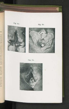 Fig. 60. Fig. 61. Fig. 62.