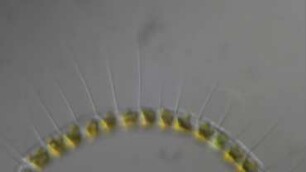 Chaetoceros curvisetus Sylt 2015