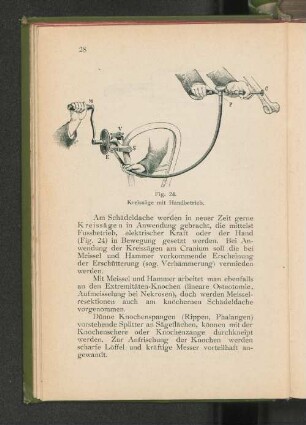 Fig. 24. Kreissäge mit Handbetrieb.