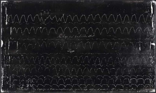 [Graphical recordings: respiration]
