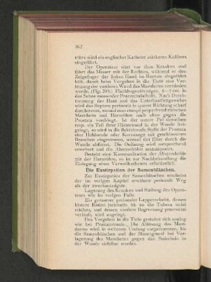 Die Exstirpation der Samenbläschen.