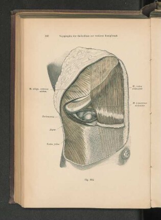 Fig. 314. Topographie der Gallenblase zur vorderen Rumpfwand.