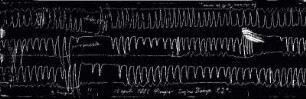 [Graphical recordings]
