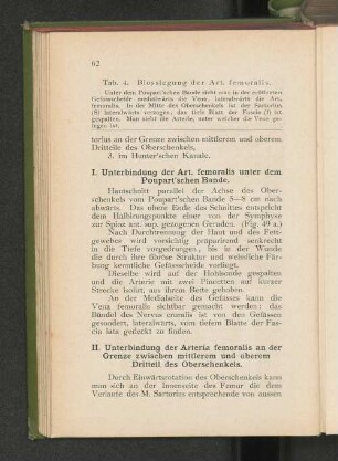 II. Unterbindung der Arteria femoralis an der Grenze zwischen mittlerem und oberem Dritteil des Oberschenkels.
