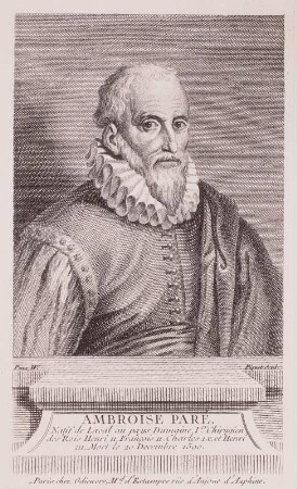 Ambroise Paré