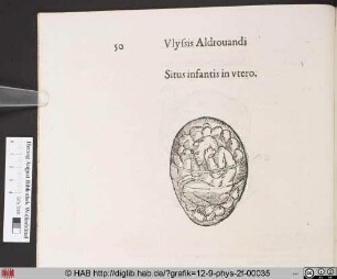 Situs infantis in vtero.