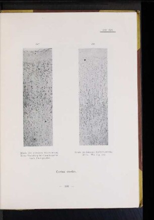 Cortex cerebri.