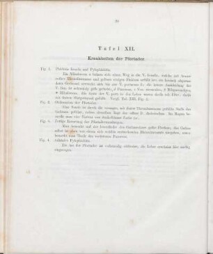 Tafel XII. Krankheiten der Pfortader.