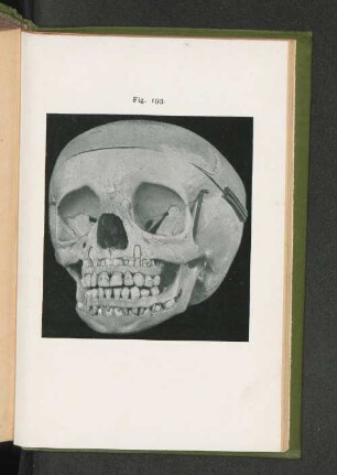 Fig. 193