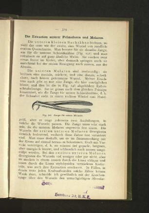 Die Extraction unterer Prämolaren und Molaren.