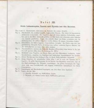Tafel III. Acute Leberatrophie, Leucin und Tyrosin aus den Secreten.