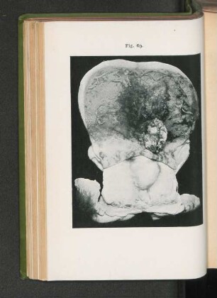 Fig. 69.
