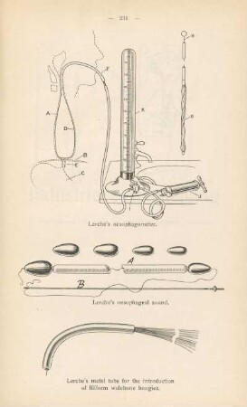 Lerche's oesophagometer ; Lerche's oesophageal sound ; Lerche's metal tube for the introduction of filiform whaleborn bougies