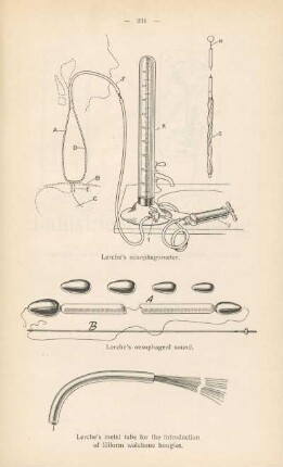 Lerche's oesophagometer ; Lerche's oesophageal sound ; Lerche's metal tube for the introduction of filiform whaleborn bougies