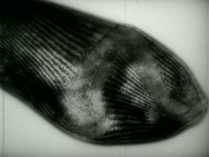 Morphogenese der Folliculiniden (Ciliata) - I. Morphologie und Zellteilung