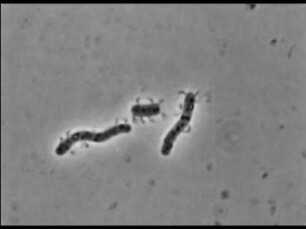 Lysis of Bacteria by the Parasite Bdellovibrio bacteriovorus