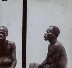Männerportrait : Anthropometrische Aufnahme eines Mannes