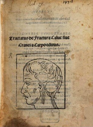 Tractatus de Fractura Calve sive Cranei