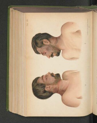 Tab. 23.
