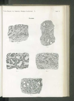 Prostata.