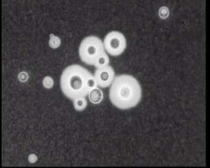 Cryptococcaceae (Imperfekte Hefen) - Vegetative Vermehrung bei Cryptococcus und Trichosporon
