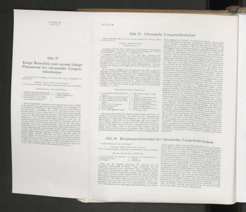 Abb. 55 Chronische Lungentuberkulose