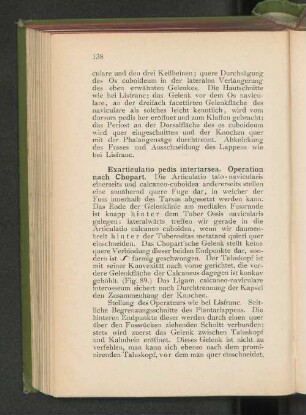 Exarticulatio pedis intertarsea. Operation nach Chopart.