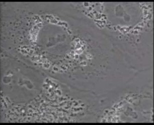 Adeno-Virus (Typ I) - Cytopathische Veränderungen in der Gewebekultur (Affennierenepithel und HEp-2)
