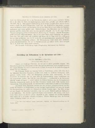 Darstellung von Gallensteinen in der Gallenblase und Leber.