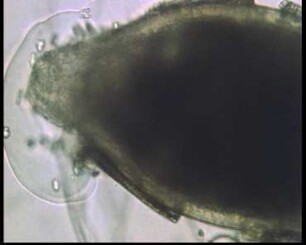 Entwicklung des Zystennematoden Heterodera schachtii