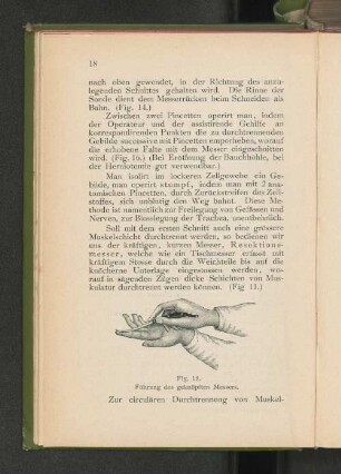 Fig. 15. Führung des geknöpften Messers.