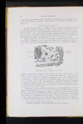 Adenoides Gewebe.