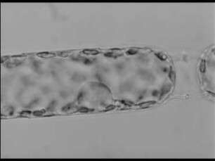 Sexual Reproduction in the Diatom Stephanopyxis turris (Centrales)