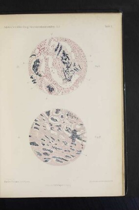 Jahrbücher d. Hamburg. Staatskrankenanstalten I.2. Tafel I bis XIII.