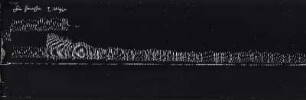 [Graphical recordings: respiration]