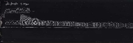 [Graphical recordings: respiration]