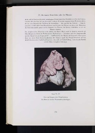 IV. Die innere Brustdrüse oder der Thymus