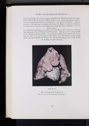 IV. Die innere Brustdrüse oder der Thymus