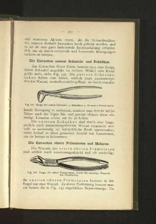 Die Extraction unterer Schneide- und Eckzähne.