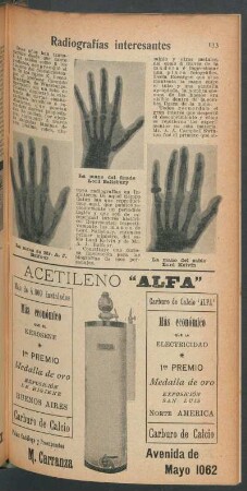 Radiografías interesantes