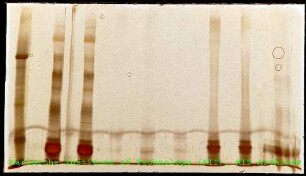 Desoxyribonukleinsäure (DNA)-Gel des Instituts für Genetik (IGEN)