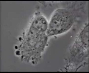 Portio-Carcinom in vitro - Stamm HeLa - Homo sapiens - Zellschädigung durch Elektronen (17 MeV)
