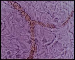 Effect of Endotoxins and Biogenic Amines in the Terminal Vascular System